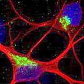 A micrograph of neurons with the mis-spliced KCNQ2 gene.
