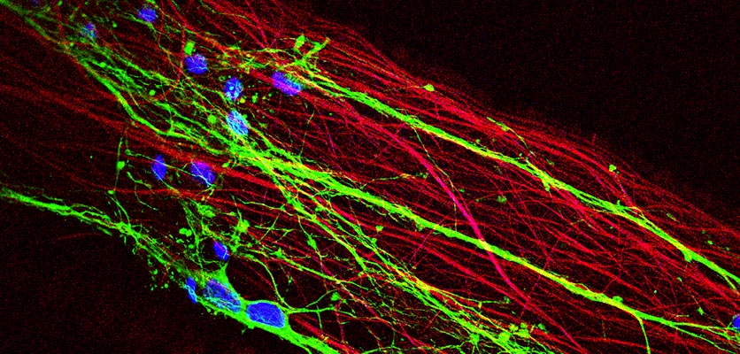 Cortical neurons 