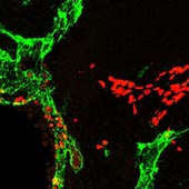 Formation of lymphatic endothelial progenitor cells