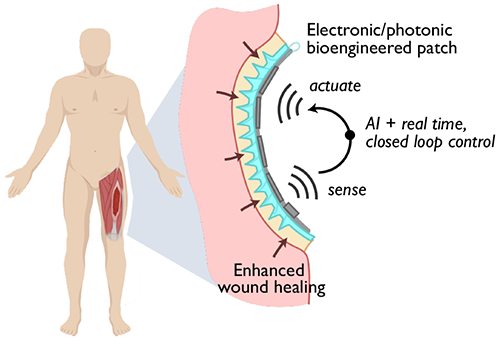 Schematic showing a bioengineered patch that will allow for enhanced and accelerated wound healing.