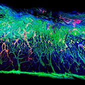 Spinal cord section