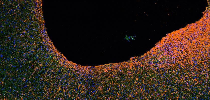 A research image showing scar formation in a human spinal cord organoid