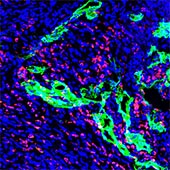 Macrophages and lymphatic cells